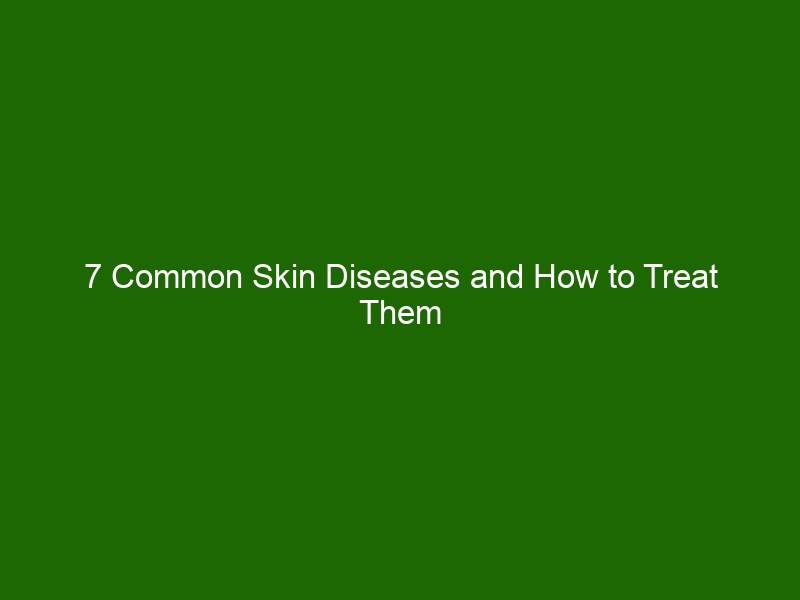 7 Common Skin Diseases and How to Treat Them - Health And Beauty