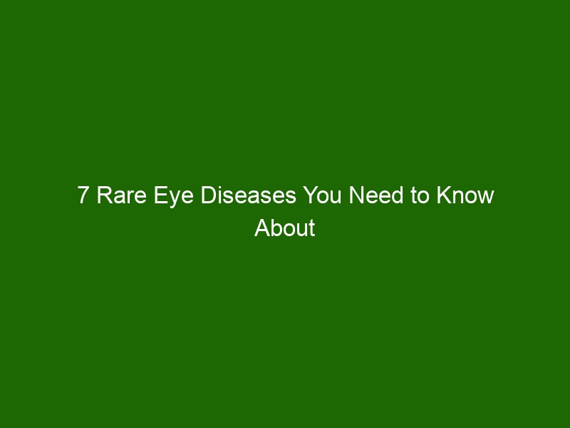 7-rare-eye-diseases-you-need-to-know-about-health-and-beauty