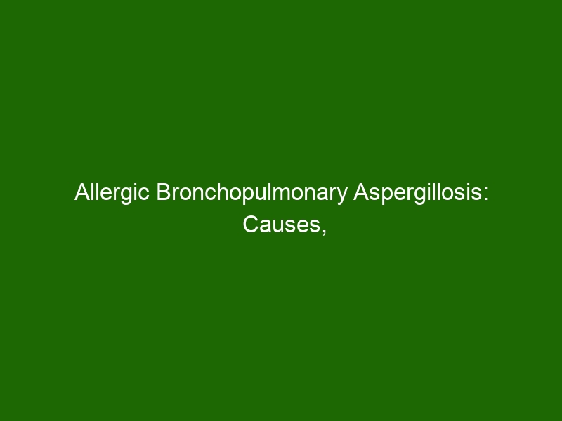 Allergic Bronchopulmonary Aspergillosis: Causes, Symptoms & Treatment ...