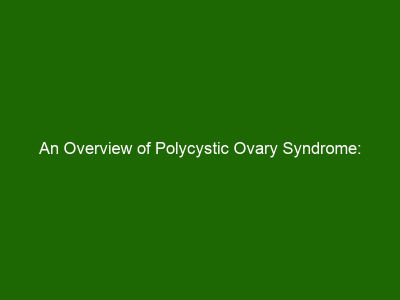 An Overview Of Polycystic Ovary Syndrome: Symptoms, Causes, And ...