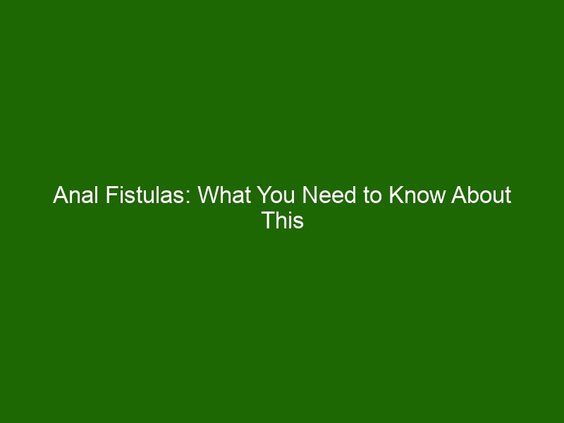 anal-fistulas-what-you-need-to-know-about-this-medical-condition