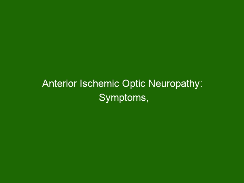 anterior-ischemic-optic-neuropathy-symptoms-causes-treatment