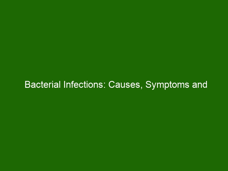 Bacterial Infections: Causes, Symptoms and Treatment Options - Health ...