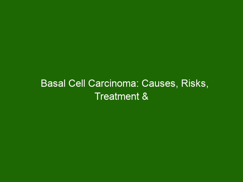 Basal Cell Carcinoma Causes Risks Treatment And Prevention Health And Beauty 0156