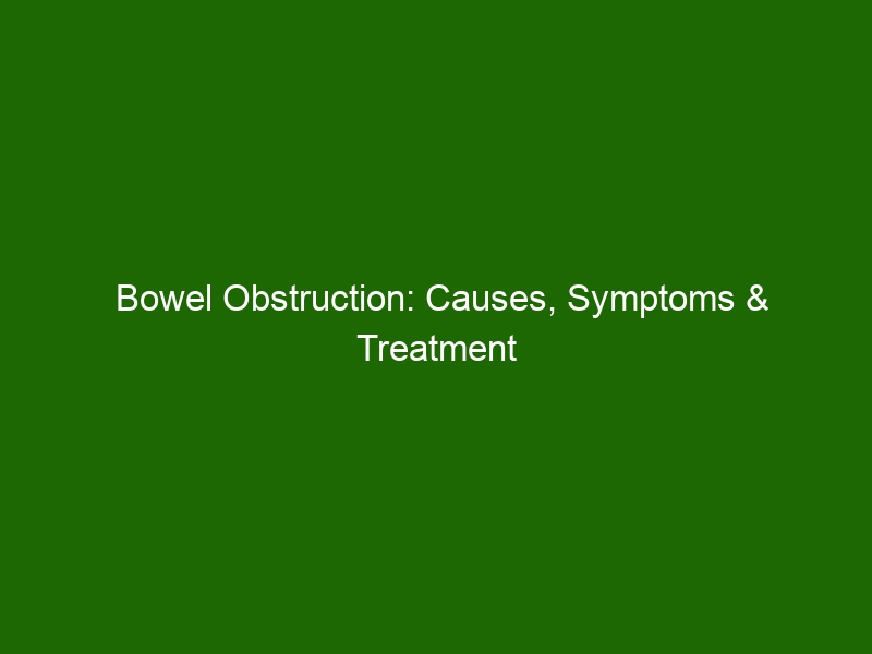 Bowel Obstruction Causes, Symptoms & Treatment Health And Beauty