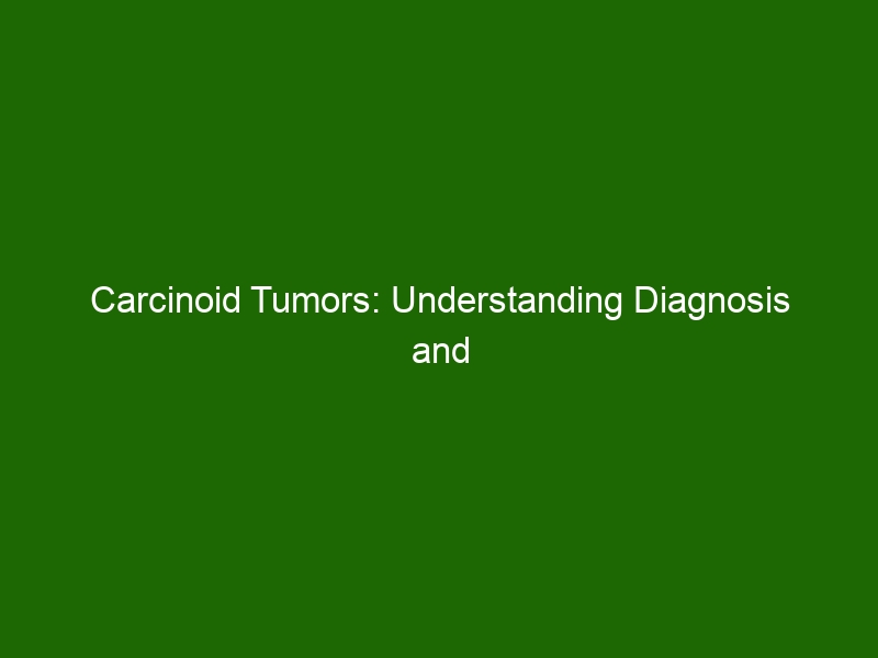 Carcinoid Tumors Understanding Diagnosis And Treatment Options