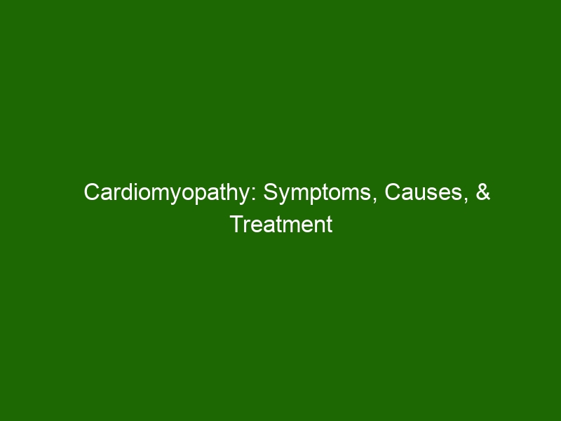 Cardiomyopathy Symptoms Causes And Treatment Options Health And Beauty