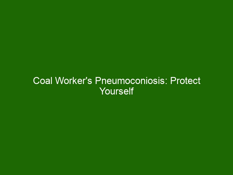 Coal Worker's Pneumoconiosis: Protect Yourself from the Dangers of ...