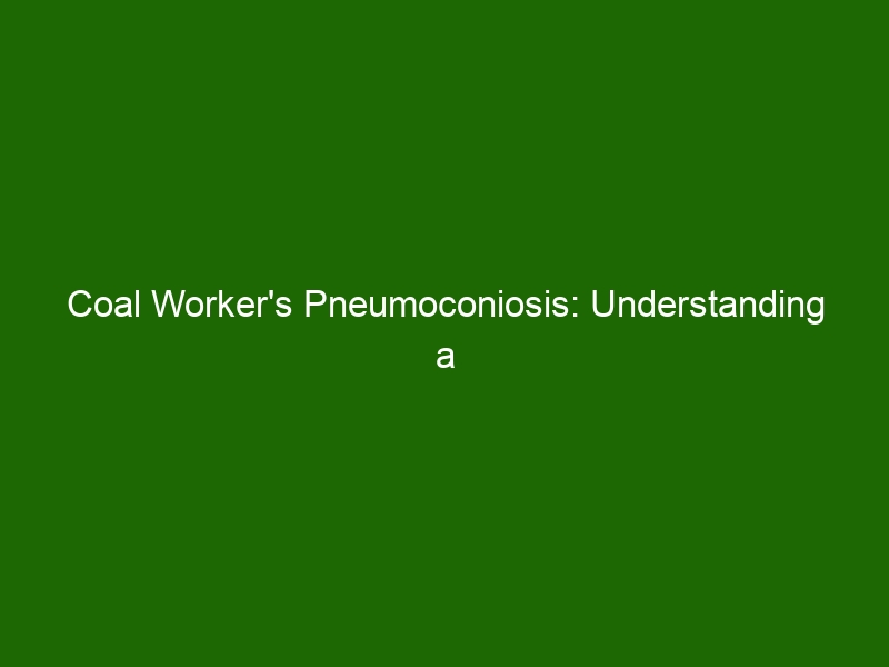 Coal Worker's Pneumoconiosis: Understanding a Potentially Fatal Disease ...