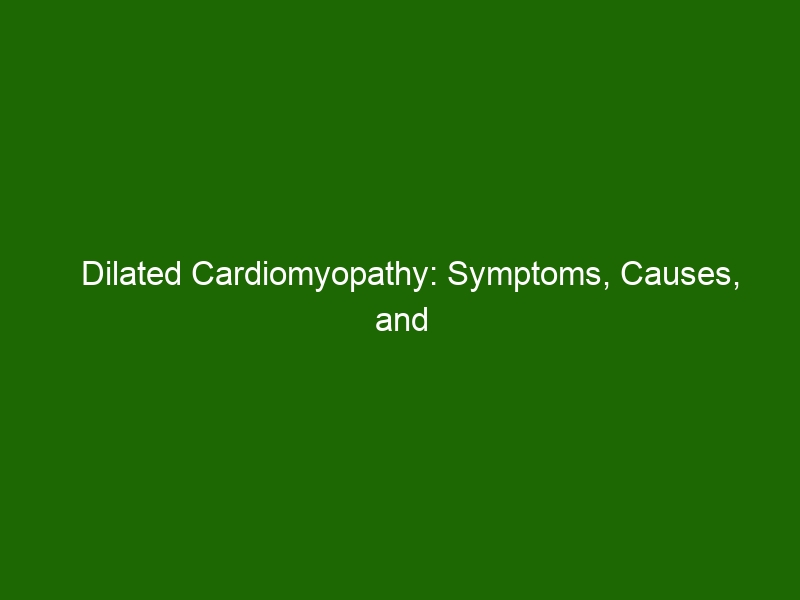 dilated-cardiomyopathy-symptoms-causes-and-treatments-health-and