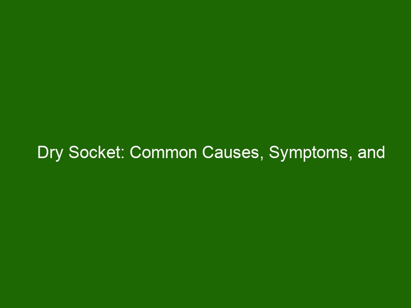 Dry Socket Common Causes Symptoms And Treatments Health And Beauty 0441