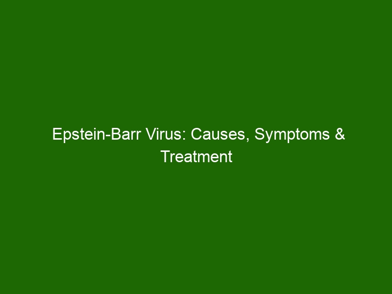 Epstein Barr Virus Causes Symptoms And Treatment Of Ebv Infection Health And Beauty 9956