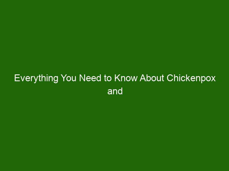 Everything You Need to Know About Chickenpox and How to Treat It ...