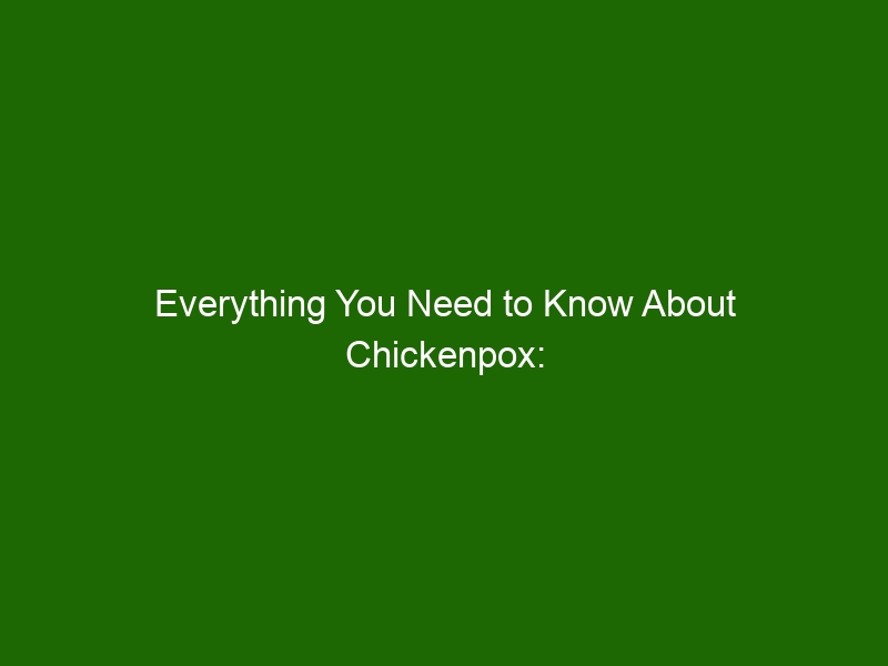 Everything You Need to Know About Chickenpox: Symptoms, Treatment, and ...