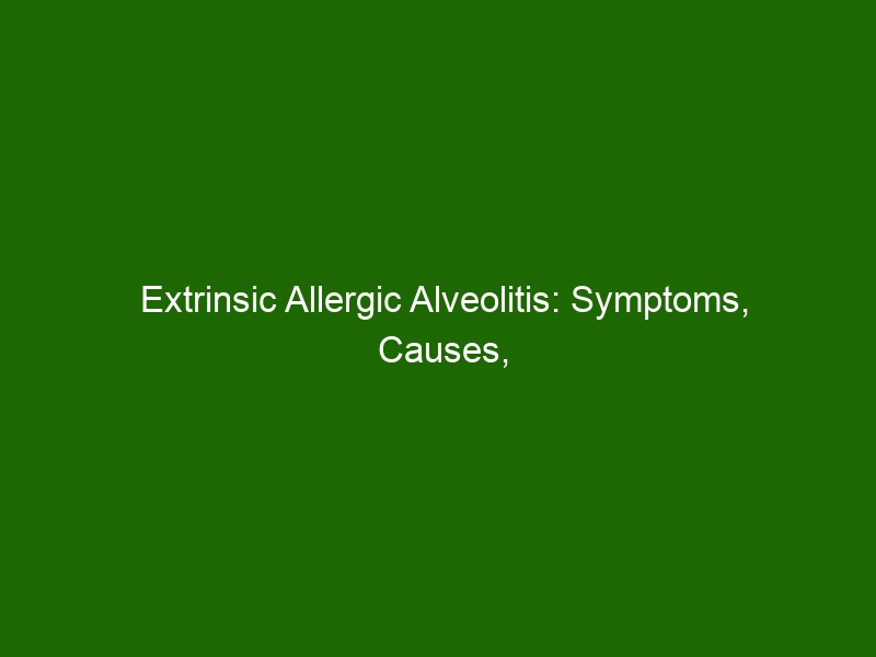 Extrinsic Allergic Alveolitis Symptoms Causes Diagnosis And Treatment Health And Beauty