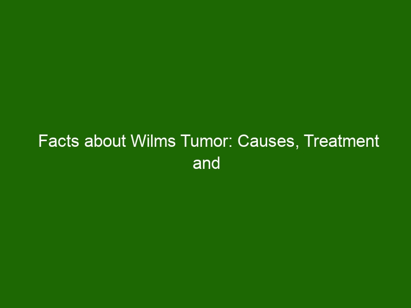 Facts About Wilms Tumor Causes Treatment And What To Expect Health