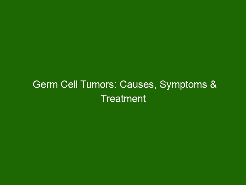 germ-cell-tumors-causes-symptoms-treatment-health-and-beauty