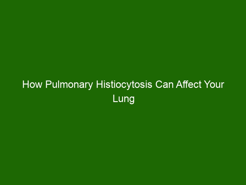 How Pulmonary Histiocytosis Can Affect Your Lung Health - Health And Beauty