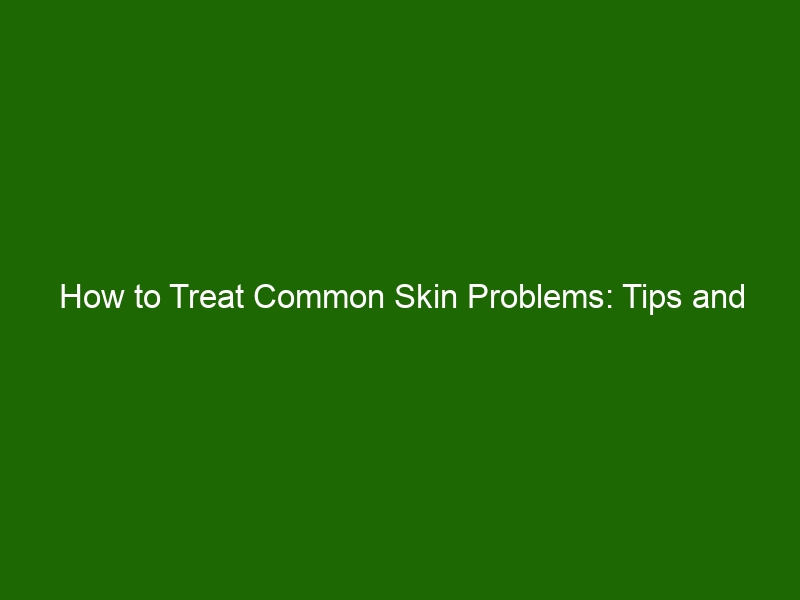 How To Treat Common Skin Problems Tips And Solutions Health And Beauty