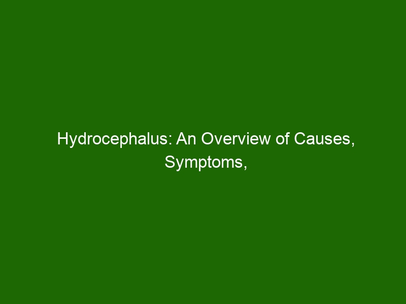 Hydrocephalus: An Overview of Causes, Symptoms, and Treatment - Health ...