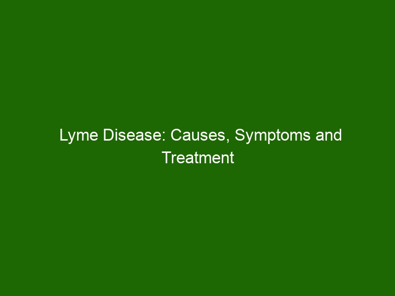 Lyme Disease: Causes, Symptoms And Treatment Options - Health And Beauty