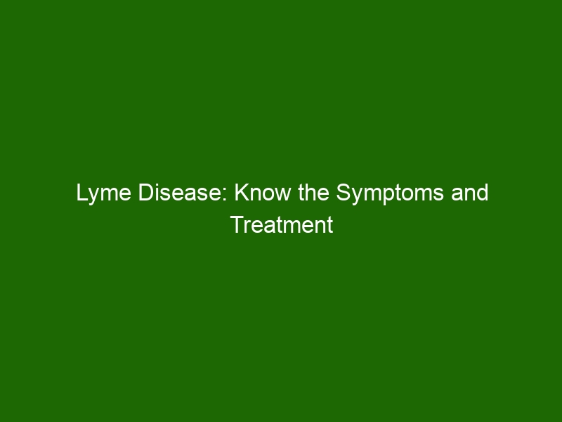 Lyme Disease: Know the Symptoms and Treatment Options - Health And Beauty