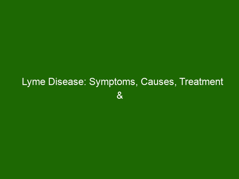 Lyme Disease Symptoms Causes Treatment And Diagnosis Health And Beauty