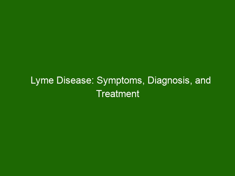 Lyme Disease: Symptoms, Diagnosis, and Treatment - Health And Beauty