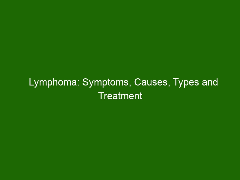 Lymphoma: Symptoms, Causes, Types And Treatment Options - Health And Beauty