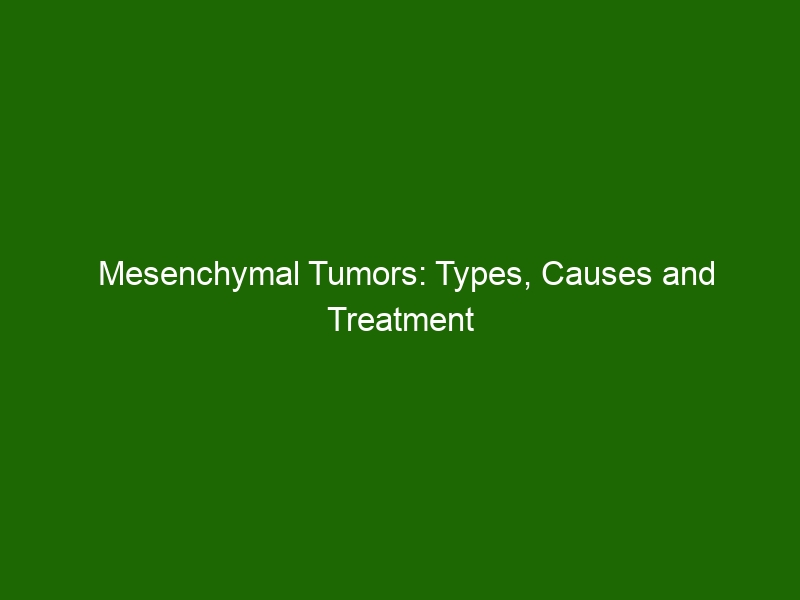 Mesenchymal Tumors: Types, Causes and Treatment - Health And Beauty