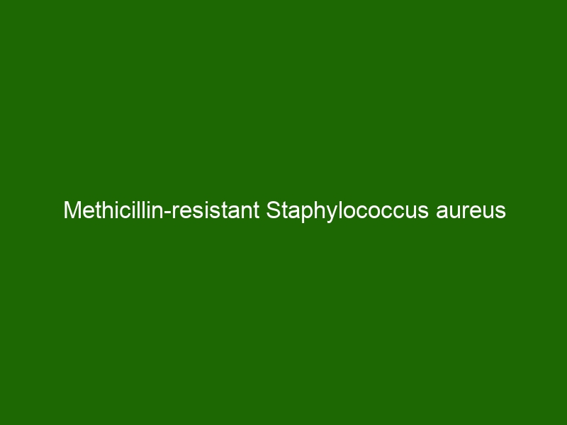 Methicillin Resistant Staphylococcus Aureus Mrsa Prevention