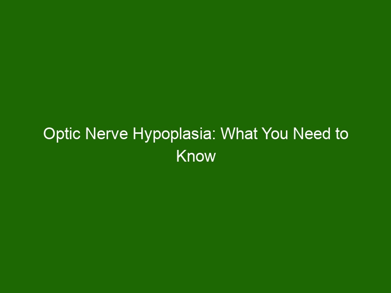 optic-nerve-hypoplasia-what-you-need-to-know-health-and-beauty