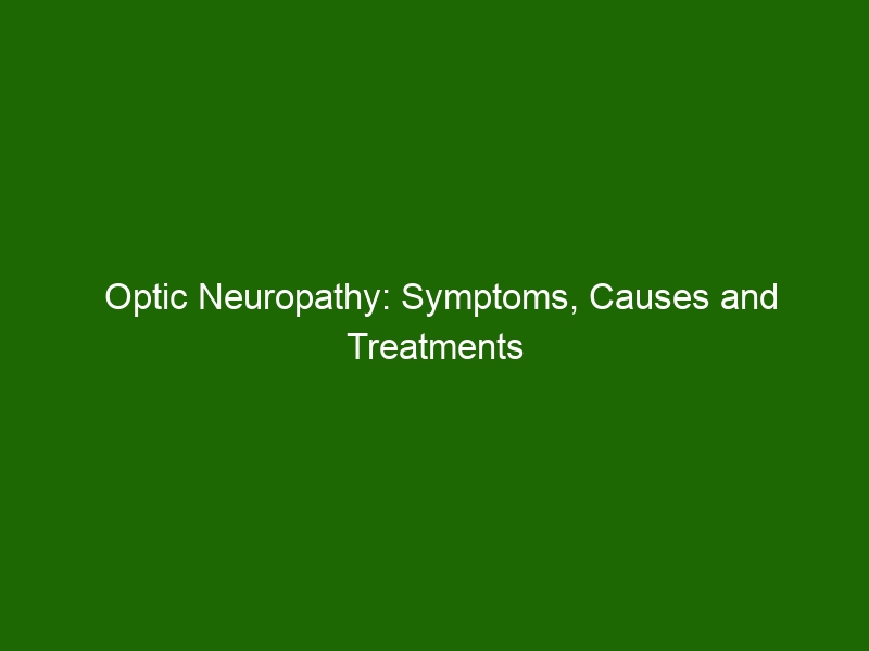 ppt-ischemic-optic-neuropathy-powerpoint-presentation-free-download