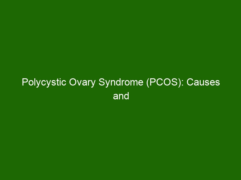 Polycystic Ovary Syndrome Pcos Causes And Management Health And Beauty 0426