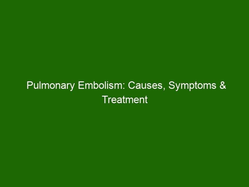 Pulmonary Embolism: Causes, Symptoms & Treatment of Dangerous Blood ...