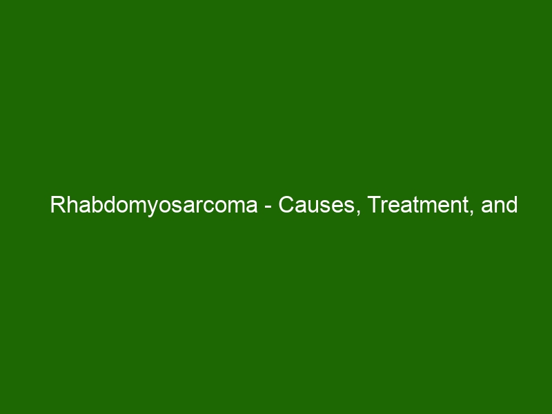 Rhabdomyosarcoma - Causes, Treatment, and Prognosis - Health And Beauty