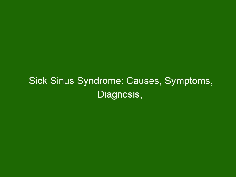 Sick Sinus Syndrome Causes Symptoms Diagnosis And Treatment