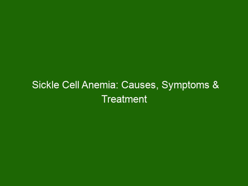 Sickle Cell Anemia: Causes, Symptoms & Treatment - Health And Beauty