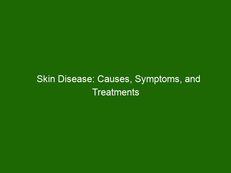 skin-disease-causes-symptoms-and-treatments-health-and-beauty