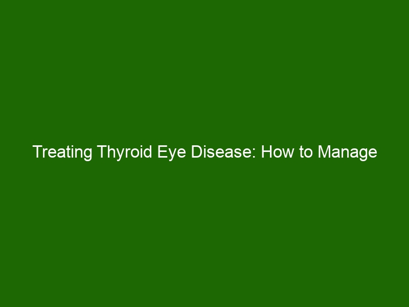 Treating Thyroid Eye Disease How To Manage Symptoms And Sight Loss Health And Beauty 6820