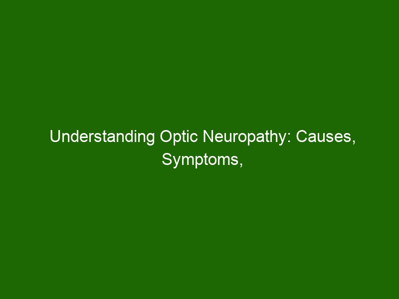 Understanding Optic Neuropathy: Causes, Symptoms, Diagnosis & Treatment ...