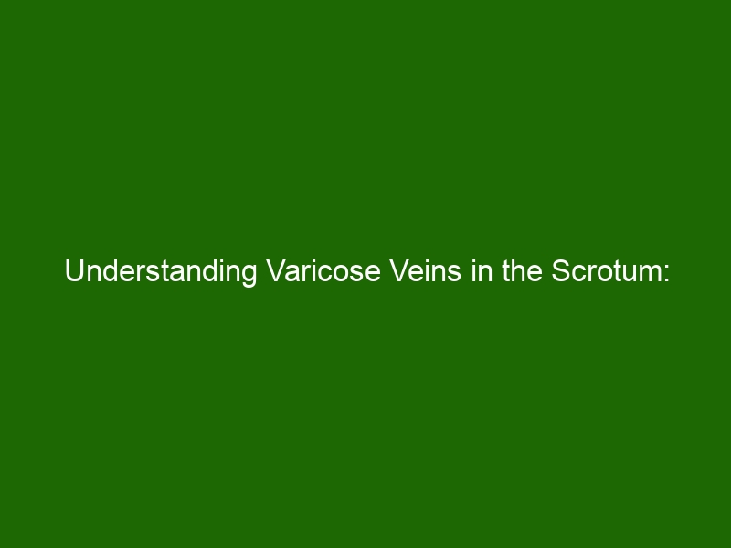 Understanding Varicose Veins In The Scrotum Causes Treatment And Prevention Health And Beauty