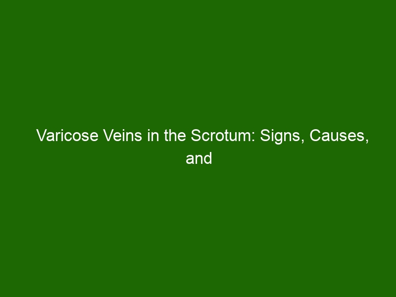 Varicose Veins In The Scrotum Signs Causes And Treatment Health