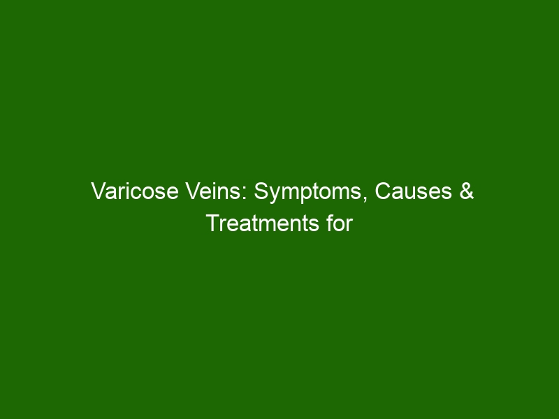 Varicose Veins: Symptoms, Causes & Treatments for Swollen Veins in the ...