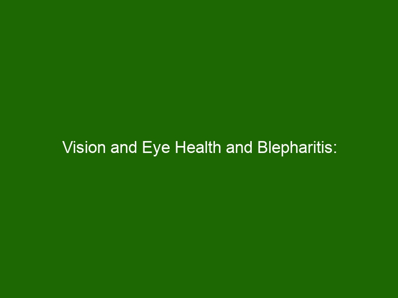 Vision And Eye Health And Blepharitis Understanding Symptoms And Treatment Options Health And