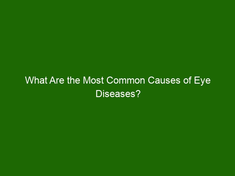 What Are the Most Common Causes of Eye Diseases? Health And Beauty