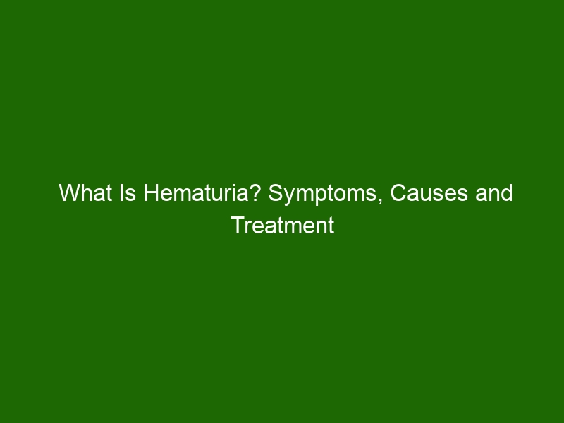 What Is Hematuria? Symptoms, Causes And Treatment Of Blood In Urine ...