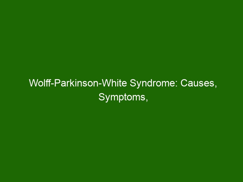 Wolff-Parkinson-White Syndrome: Causes, Symptoms, and Treatment Options ...