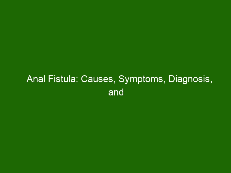 Anal Fistula Causes Symptoms Diagnosis And Treatments Health And Beauty 