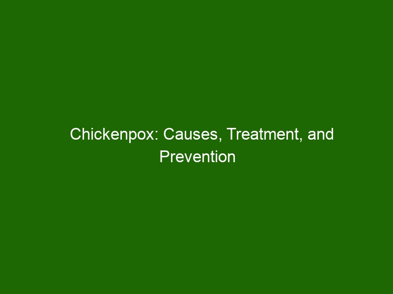 Chickenpox: Causes, Treatment, and Prevention Tips for Kids - Health ...